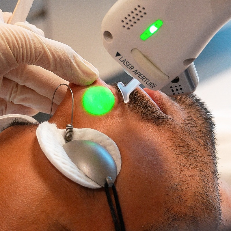 Full Body Hair Removal 